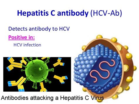 Hepatitis C antibody: Test of Hepatitis C .